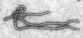 エボラウイルスの顕微鏡画像.jpg